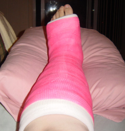 if i have to have a cast, it better be pink.